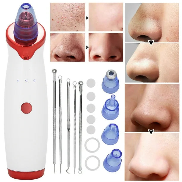 SkinPro™ - Extractor de impurezas