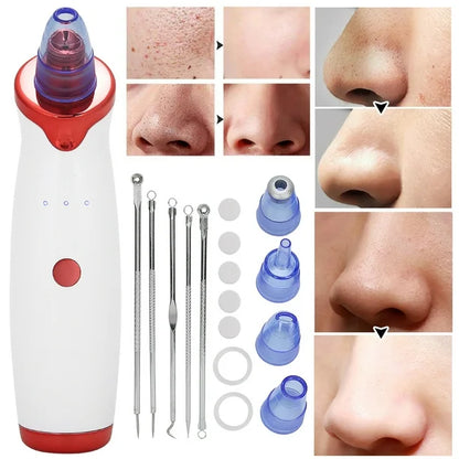 SkinPro™ - Extractor de impurezas